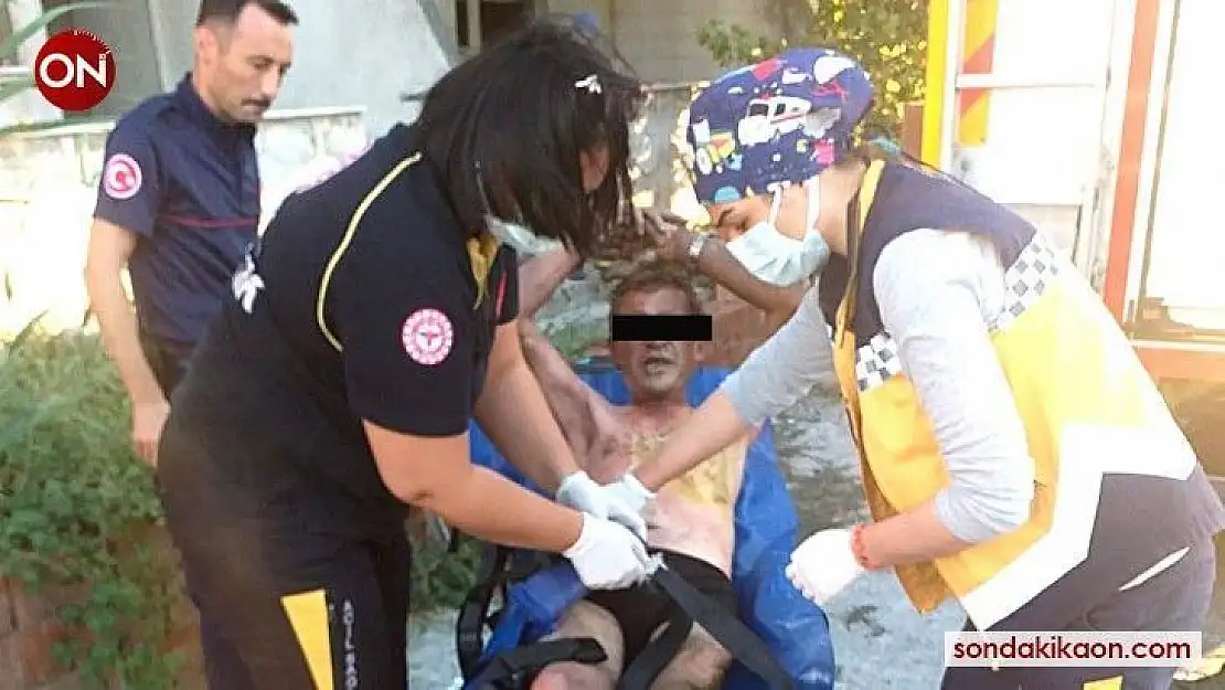 Balıkesir'de inşaatta çöpler yandı, söndürmeye çalışan kişi de yandı