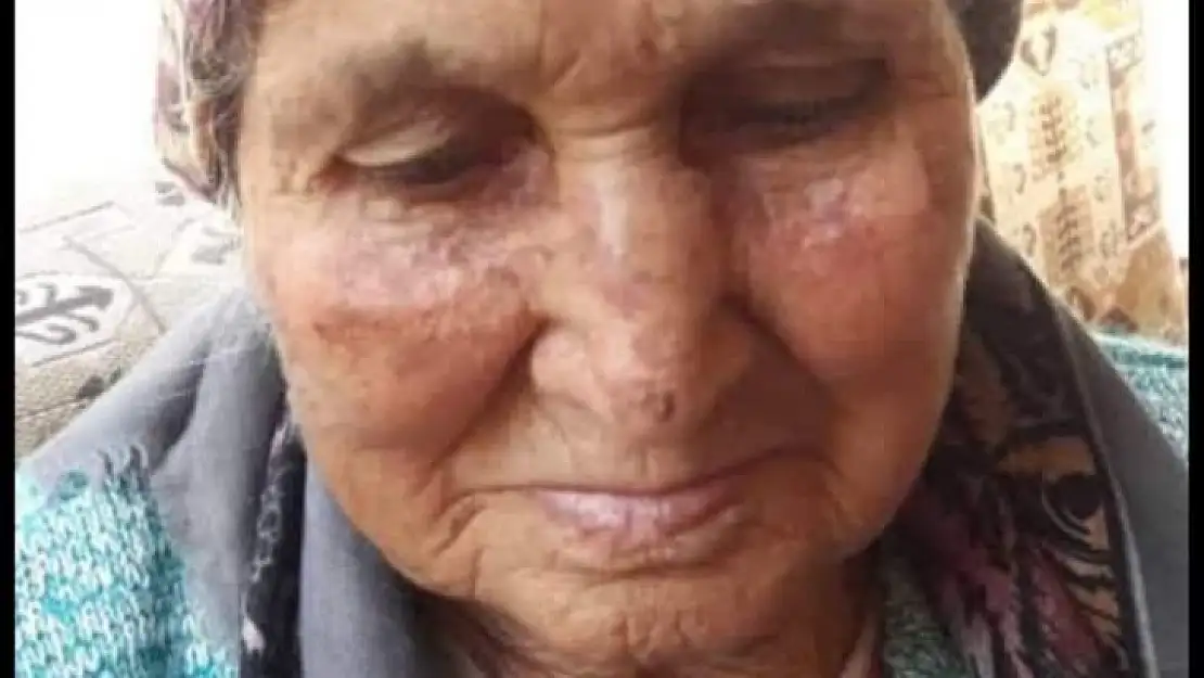 Bir gün içinde hem annesini hem de kayınvalidesini kaybetti