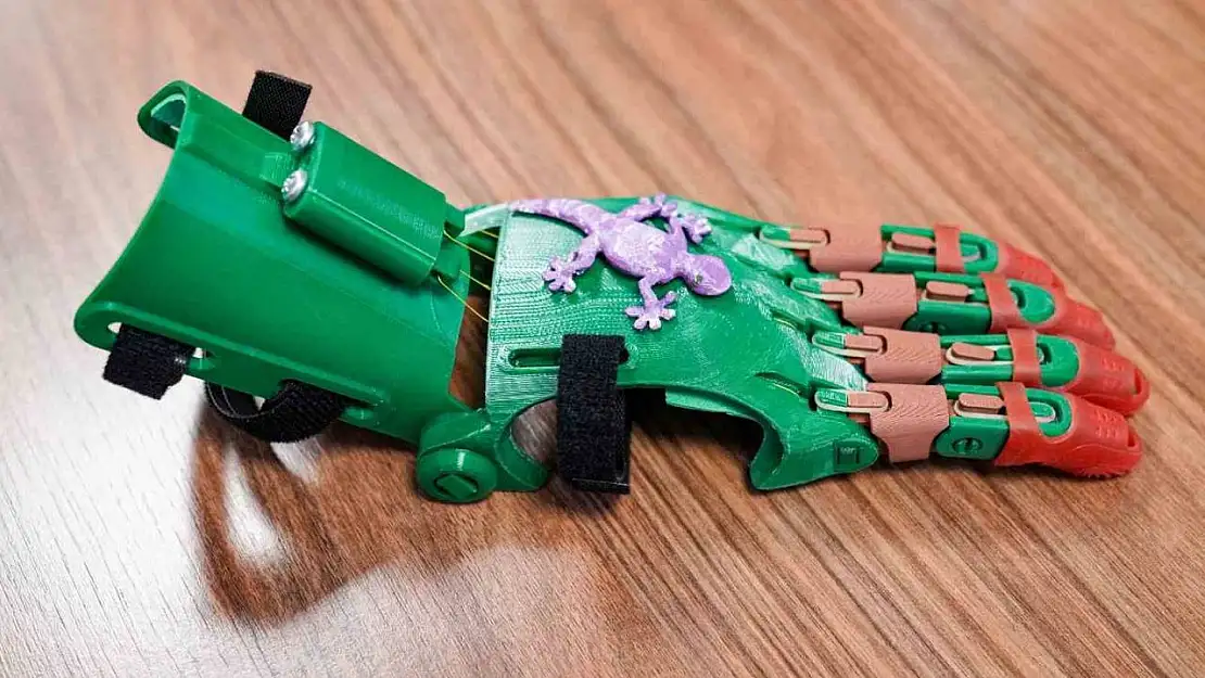 Büyükşehir çocuklara robot el ile umut olacak
