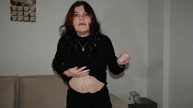 'Estetik mağduru' kadın, profesör hakkında suç duyurusunda bulundu