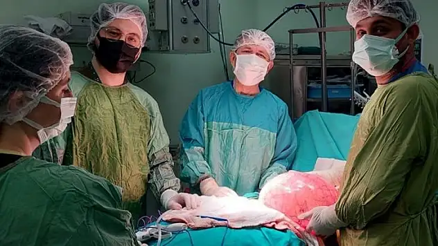 30 santimetrelik yumurtalık tümörü başarılı bir operasyonla çıkartıldı
