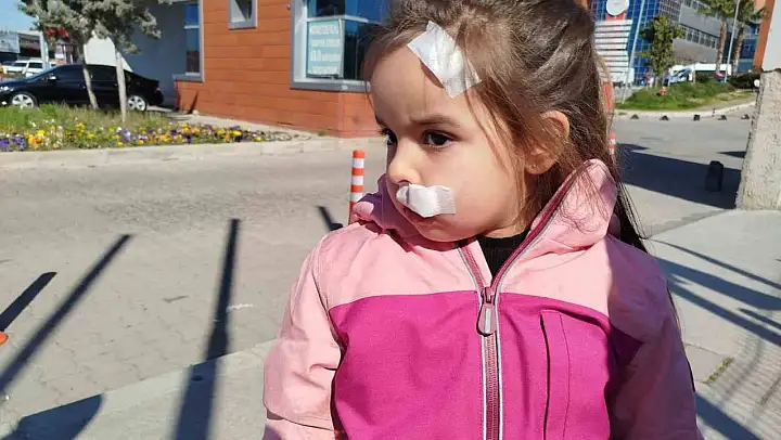 İzmir'de AVM'deki sahipsiz köpek 3 yaşındaki Elif'e saldırdı