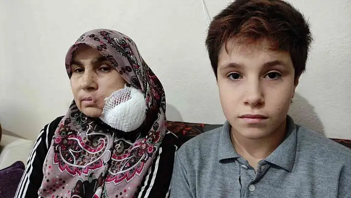 Yüzündeki dev kitleden kurtulmak için yardım bekliyor