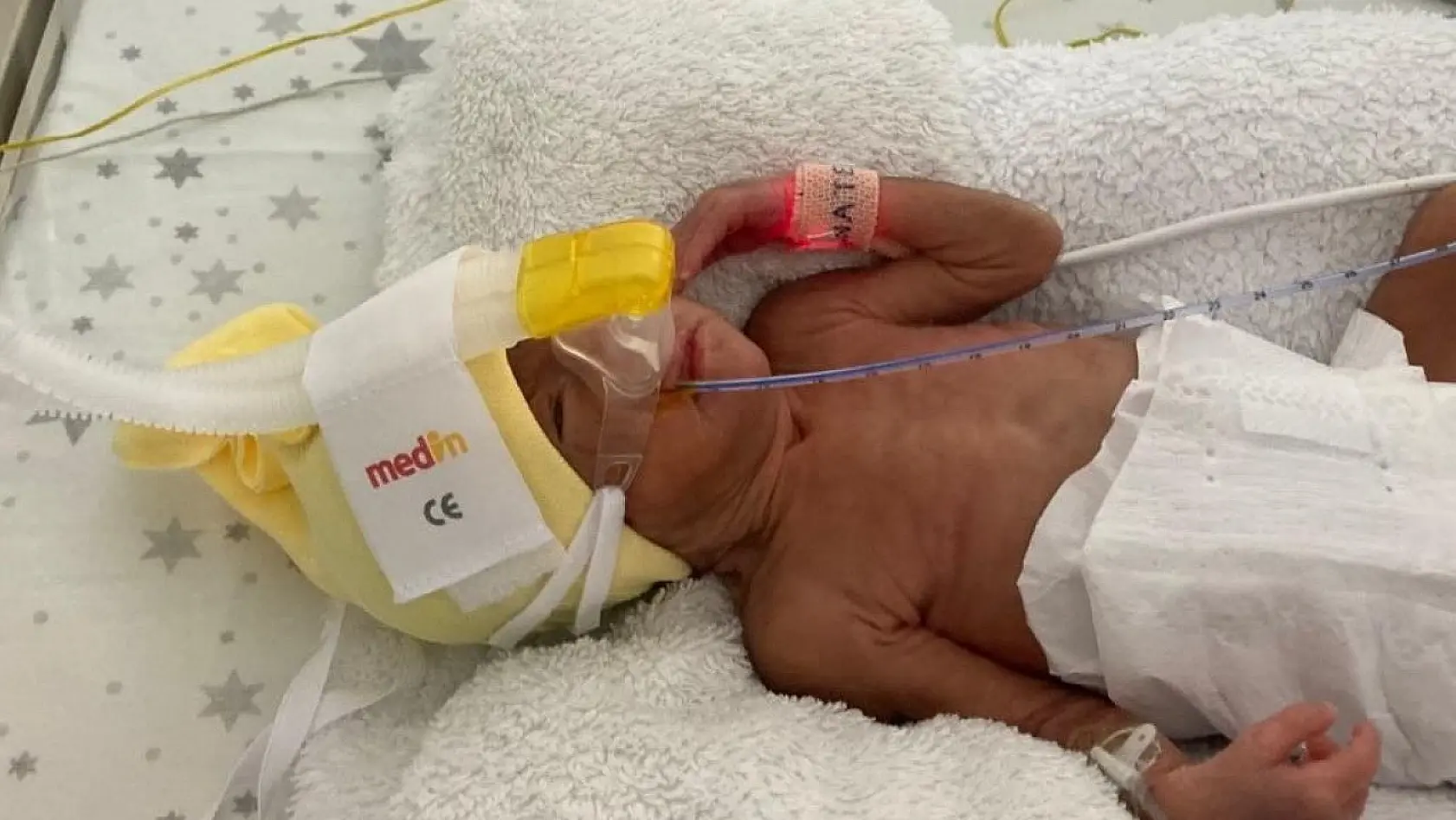 850 gramlık Birsen Asel bebek, 100 günde yaşama tutundu